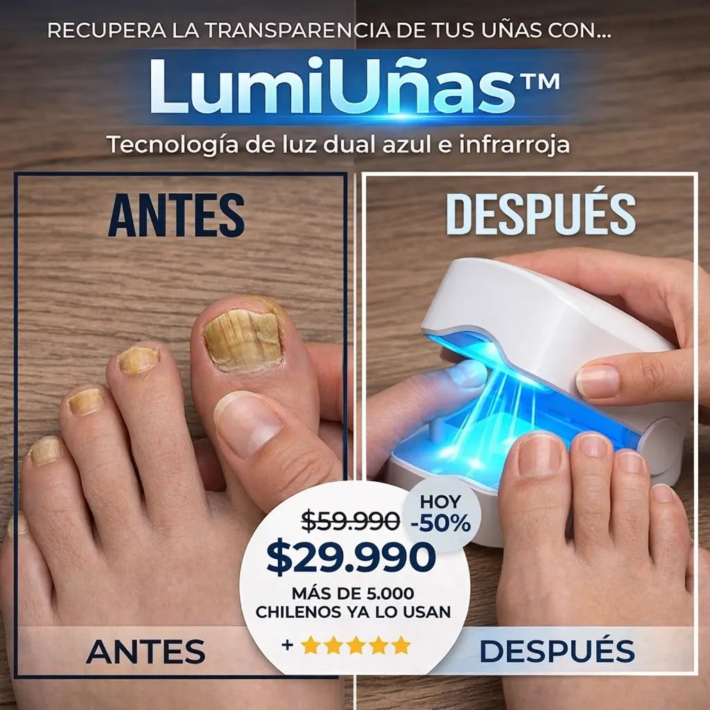 LumiUñas: Elimina Hongos de las Uñas